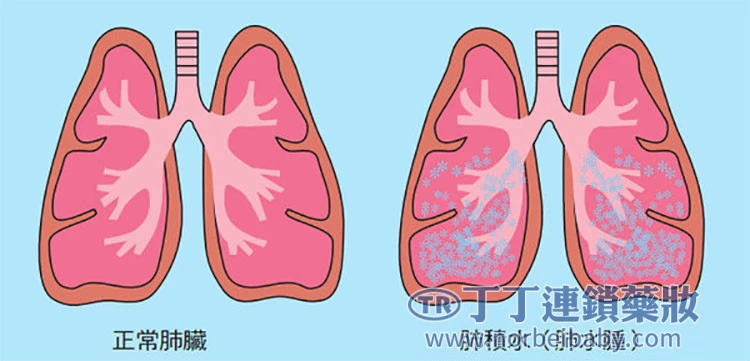 威而鋼預防與緩解差異