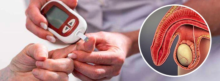 糖尿病患者使用犀利士 糖尿病患者使用犀利士
